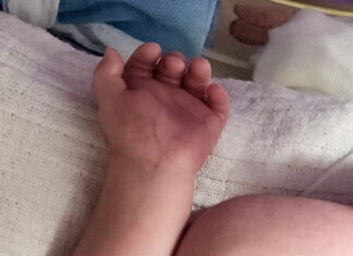 33 tygodniowe maleństwo hospicyjne jest już Dzieckiem Bożym!